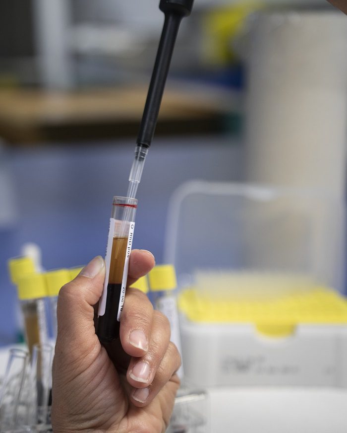 αιματολογικός έλεγχος αιματολογικός έλεγχος