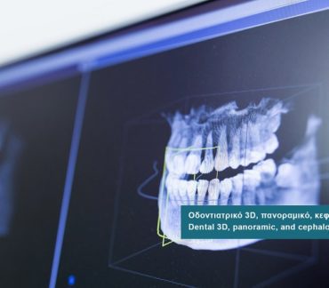 Dental 3D Xray