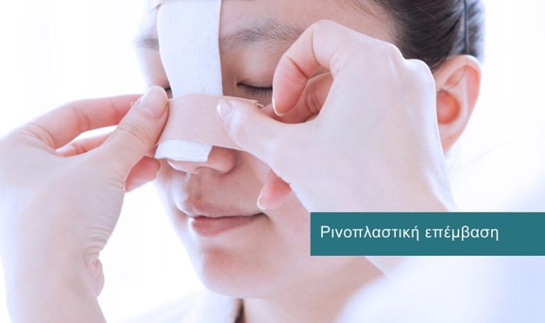 Ρινοπλασιτκή Επέμβαση Ρινοπλαστική Επέμβαση
