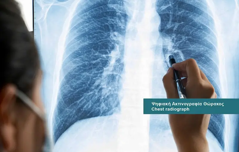 Pulmonology and Tuberculosis services at DIKTEON Medical Diagnostic Center in Strovolos - Nicosia - Cyprus / Υπηρεσίες Πνευμονολογίας - Φυματιολογίας στο ΔΙΚΤΑΙΟΝ Ιατρικό Διαγνωστικό Κέντρο στο Στρόβολο - Λευκωσία - Κύπρος.