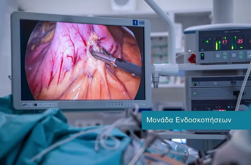 Gastrointestinal (GI) Endoscopy at DIKTEON Medical Diagnostic Center in Strovolos - Nicosia - Cyprus. / Υπηρεσίες Ενδοσκόπησης Πεπτικού στο ΔΙΚΤΑΙΟΝ Ιατρικό Διαγνωστικό Κέντρο στο Στρόβολο - Λευκωσία - Κύπρος.